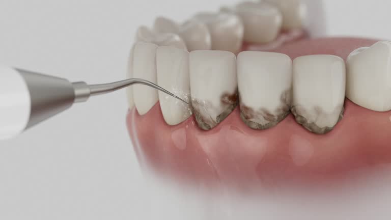 Reliable Dental Implants contractor in Jay, OK by Smile Center Dentistry